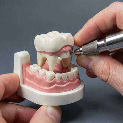 a shade guide held against a tooth model