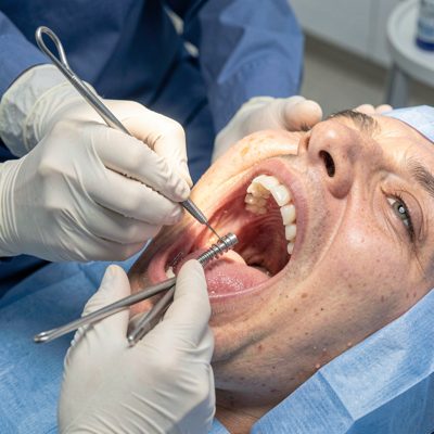 oral surgeon preparing incision site before implant placement